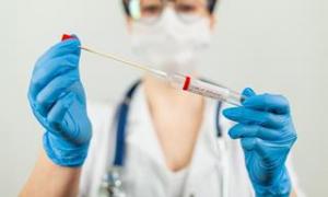 Las pruebas privadas por coronavirus deberán informarse al área de salud 